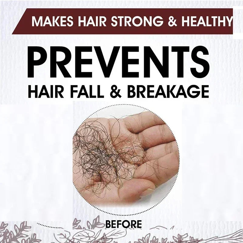 Fast Hair Growth for Men Women Ginger Oil Care Anti Hair Loss Scalp Treatment Serum Beauty Health Products