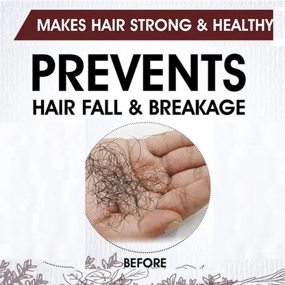 Fast Hair Growth for Men Women Ginger Oil Care Anti Hair Loss Scalp Treatment Serum Beauty Health Products